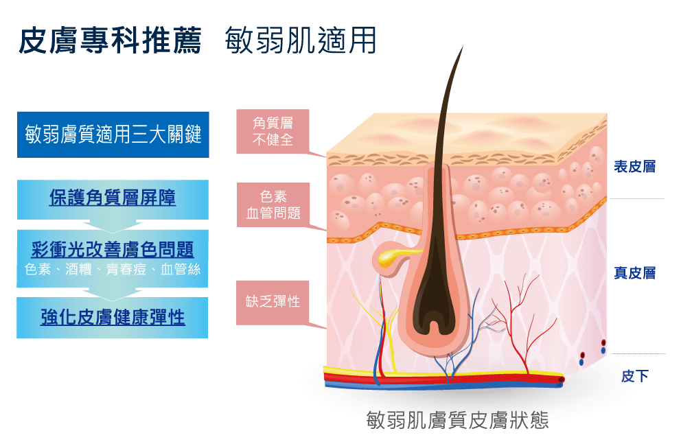 M22敏感肌適用3大關鍵