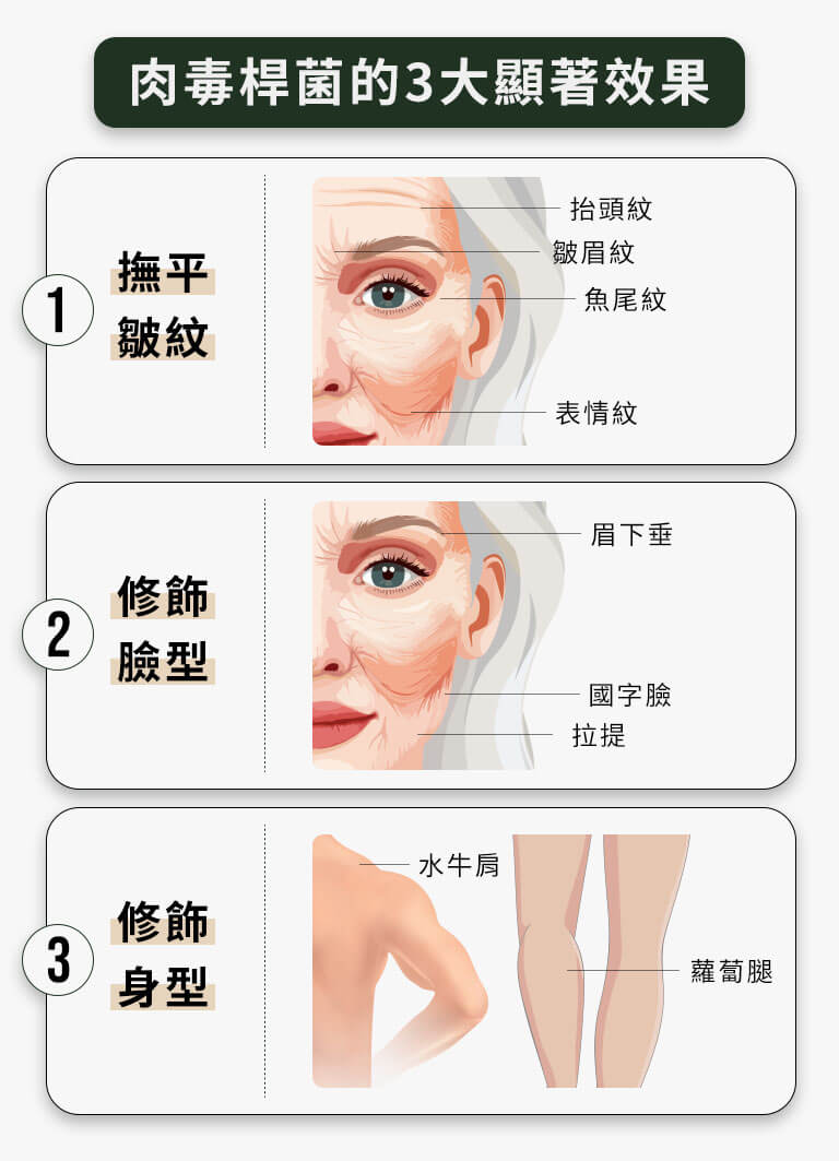 肉毒桿菌的3大顯著效果-撫平皺紋、修飾臉型、修飾身型