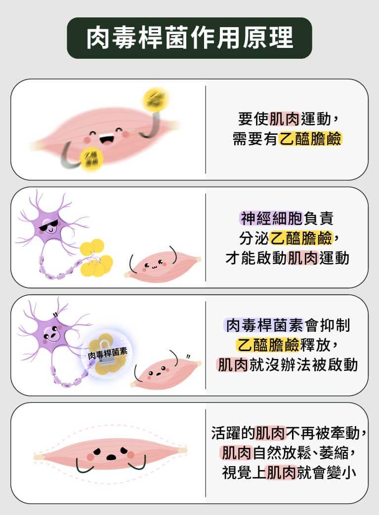 肉毒桿菌作用原理過程